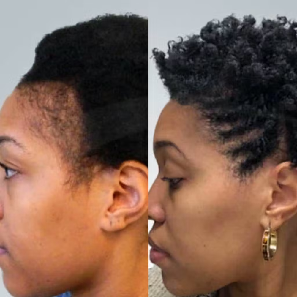 <h2>⭐⭐⭐⭐⭐<br/>Découvrez pourquoi <strong>plus de 10 000 clientes</strong> adorent nos produits… 💙</h2>