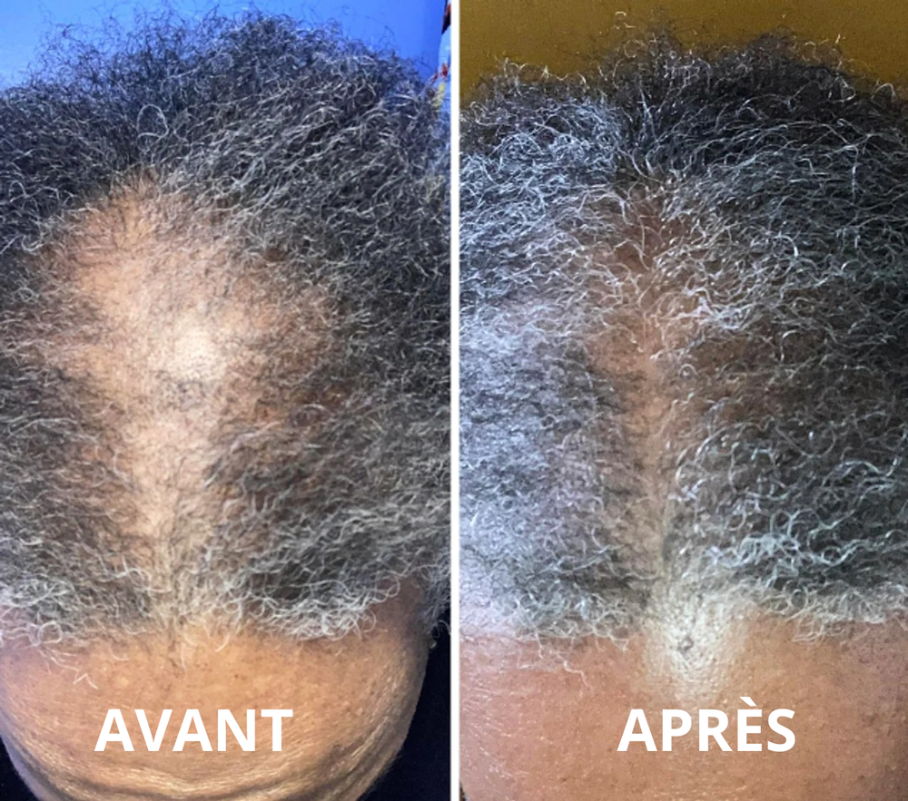 <h2>⭐⭐⭐⭐⭐<br/>Découvrez pourquoi <strong>plus de 10 000 clientes</strong> adorent nos produits… 💙</h2>