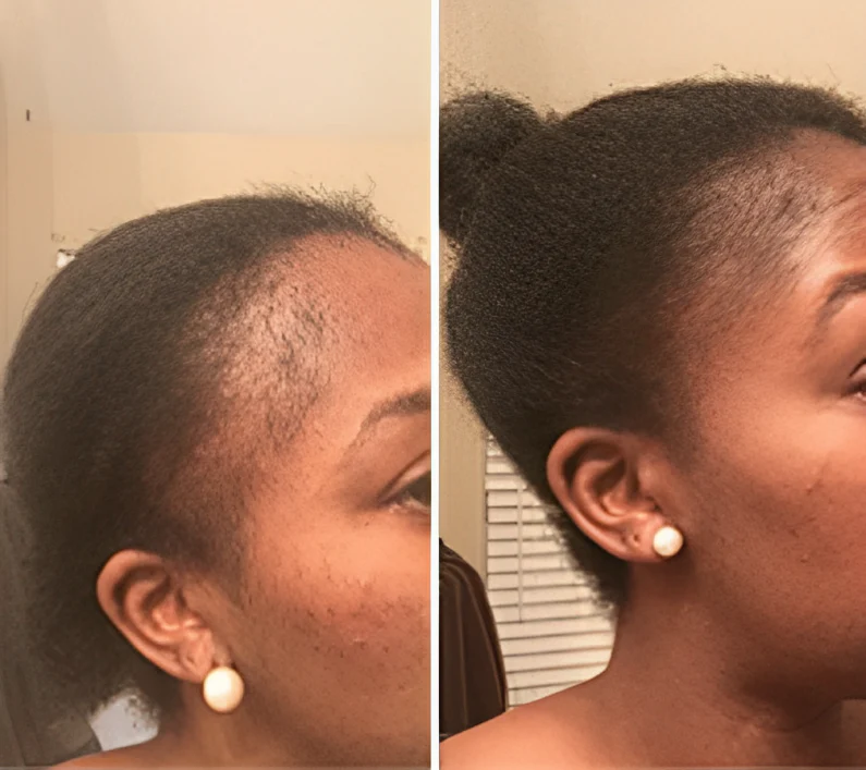 <h2>⭐⭐⭐⭐⭐<br/>Découvrez pourquoi <strong>plus de 10 000 clientes</strong> adorent nos produits… 💙</h2>