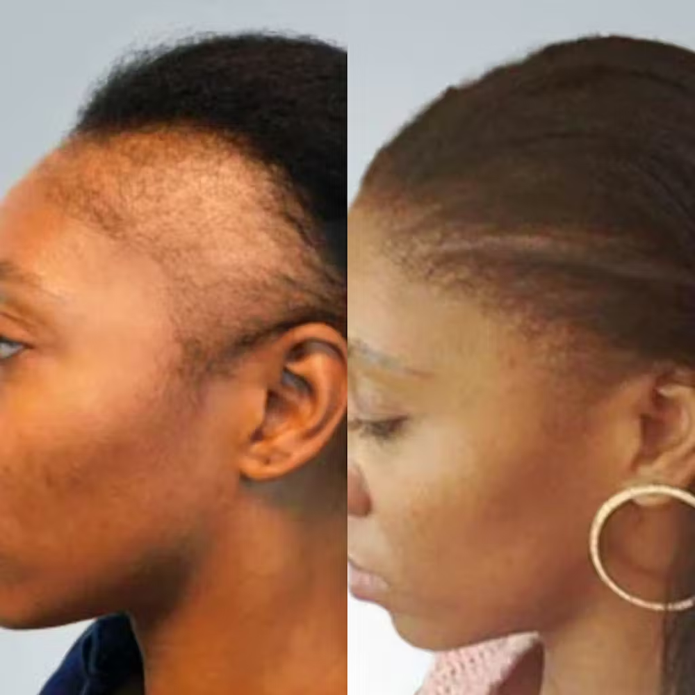 <h2>⭐⭐⭐⭐⭐<br/>Découvrez pourquoi <strong>plus de 10 000 clientes</strong> adorent nos produits… 💙</h2>